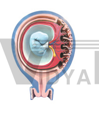 The model of relation between fetus fetal membranes and uterus (1part)